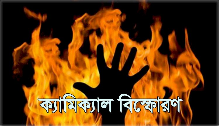 রংপুরে কেমিক্যালের বয়াম বিস্ফোরিত হয়ে দুই শিশু দগ্ধ